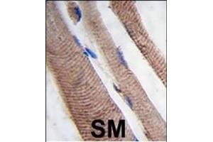 Formalin-fixed and paraffin-embedded human skeletal muscle tissue reacted with PI3KC3 Antibody (S34), which was peroxidase-conjugated to the secondary antibody, followed by DAB staining.