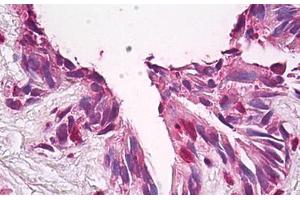Anti-FUZ / FY antibody IHC staining of human lung. (FUZ 抗体  (AA 338-355))