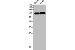 Western blot analysis of HELA A549 Cell Lysate, antibody was diluted at 1:1000. (DCT 抗体  (AA 1268-1341))