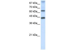 WB Suggested Anti-ZNF79 Antibody Titration:  0. (ZNF79 抗体  (N-Term))