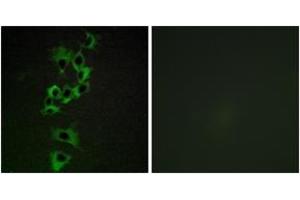 Immunofluorescence analysis of HepG2 cells, using HER4 (Ab-1284) Antibody. (ERBB4 抗体  (AA 1250-1299))