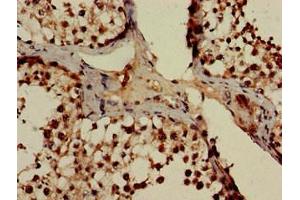 Immunohistochemistry of paraffin-embedded human testis tissue using ABIN7164998 at dilution of 1:100 (POT1 抗体  (AA 250-432))