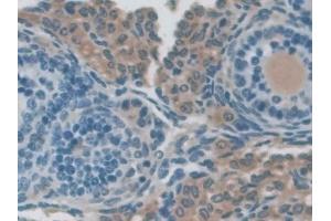 Immunohistochemistry (IHC) image for anti-Nucleoredoxin (NXN) (AA 167-435) antibody (ABIN7439750)
