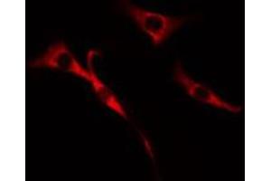 ABIN6272650 staining Hela cells by IF/ICC. (CDC37L1 抗体  (Internal Region))
