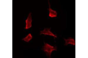 ABIN6275952 staining RAW264. (GPR109 抗体)