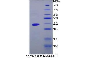 SDS-PAGE analysis of Human MGA Protein. (AGLU 蛋白)