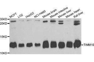 Western blot analysis of extracts of various cells, using TIMM10 antibody. (TIMM10 抗体)