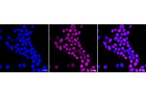 Immunocytochemical staining of HeLa cells with ISL1 antibody (ABIN7799130), 1:1,000). (Recombinant ISL1 抗体)