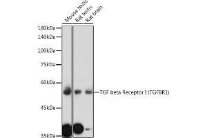 Western blot analysis of extracts of various cell lines, using TGF beta Receptor I (TGF beta Receptor I (TGFBR1)) antibody (ABIN6130733, ABIN6149081, ABIN6149082 and ABIN6213963) at 1:1000 dilution. (TGFBR1 抗体  (AA 34-124))