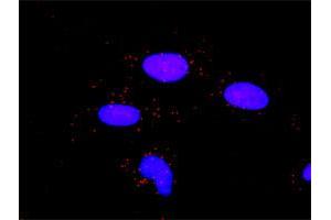 Proximity Ligation Assay (PLA) image for anti-Matrix Metalloproteinase 2 (MMP2) (AA 1-660) antibody (ABIN517955)