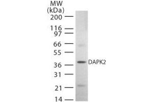 Western Blotting (WB) image for anti-Death-Associated Protein Kinase 2 (DAPK2) (AA 325-342) antibody (ABIN208411) (DAPK2 抗体  (AA 325-342))