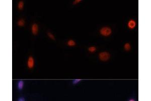 Immunofluorescence analysis of NIH/3T3 cells using p21 Polyclonal Antibody at dilution of 1:100. (p21 抗体)