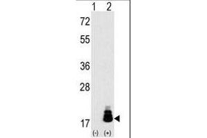 Western blot analysis of EIF4EBP1 (arrow) using rabbit polyclonal EIF4EBP1 Antibody (T69) (R). (eIF4EBP1 抗体  (AA 48-77))