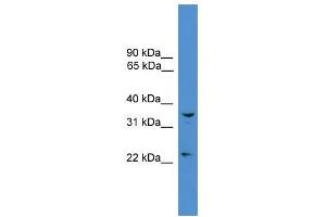 WB Suggested Anti-UCHL5 Antibody Titration: 0. (UCHL5 抗体  (Middle Region))
