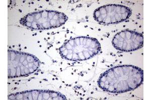 Image no. 3 for anti-TIA1 Cytotoxic Granule-Associated RNA Binding Protein (TIA1) antibody (ABIN1501387)