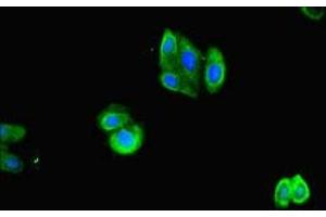 Immunofluorescent analysis of HepG2 cells using ABIN7143067 at dilution of 1:100 and Alexa Fluor 488-congugated AffiniPure Goat Anti-Rabbit IgG(H+L) (ACTL9 抗体  (AA 1-160))