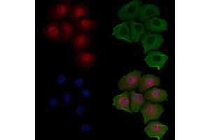 ABIN6257069 and ABIN6274978 staining Hela cells by IF/ICC. (CNOT4 抗体  (N-Term))