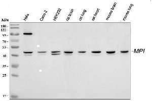 Western blot analysis of MPI using anti-MPI antibody (ABIN4886672).