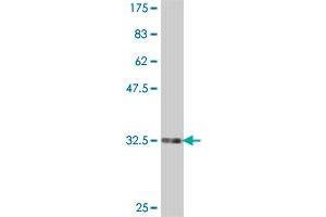 Western Blotting (WB) image for anti-Solute Carrier Family 25 (Mitochondrial Carrier, Adenine Nucleotide Translocator), Member 6 (SLC25A6) (AA 135-209) antibody (ABIN559871)
