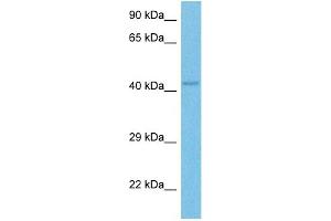 Host:  Rabbit  Target Name:  OTC  Sample Tissue:  Mouse Skeletal Muscle  Antibody Dilution:  1ug/ml (OTC 抗体  (C-Term))
