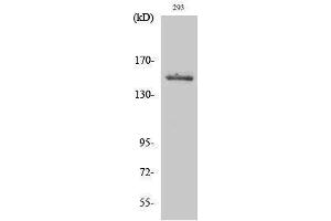 Western Blotting (WB) image for anti-Tyrosine Kinase 2 (TYK2) (Tyr260) antibody (ABIN3187388) (TYK2 抗体  (Tyr260))
