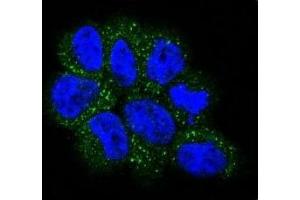 Confocal immunofluorescent analysis of NRAS antibody with NCI-H460 cells followed by Alexa Fluor 488-conjugated goat anti-rabbit lgG (green). (GTPase NRas 抗体  (AA 72-101))