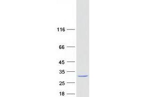 Western Blotting (WB) image for RAB6A, Member RAS Oncogene Family (RAB6A) (Transcript Variant 2) protein (Myc-DYKDDDDK Tag) (ABIN2730363)