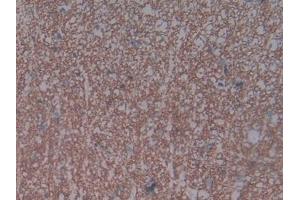 Detection of NPR3 in Rat Spinal cord Tissue using Polyclonal Antibody to Natriuretic Peptide Receptor 3 (NPR3) (NPR3 抗体  (AA 45-467))