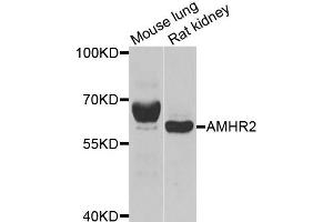 Western blot analysis of extracts of various cell lines, using AMHR2 antibody. (AMHR2 抗体)