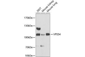 Western blot analysis of extracts of various cell lines, using VPS54 antibody (ABIN6133042, ABIN6150144, ABIN6150145 and ABIN6217132) at 1:3000 dilution. (VPS54 抗体  (AA 420-720))