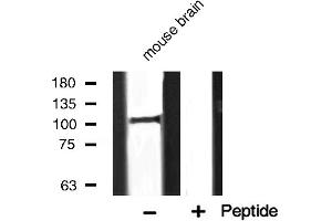 Western blot analysis of PERK expression in mouse brain (PERK 抗体  (C-Term))