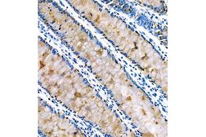 Immunohistochemistry of paraffin embedded human colon using FCGBP (ABIN7073926) at dilution of 1:800 (250x lens) (FCGBP 抗体)