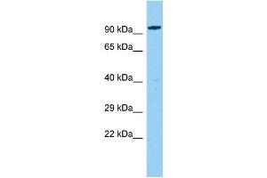 Host: Rabbit Target Name: CEP85L Sample Type: Fetal Liver lysates Antibody Dilution: 1. (C6orf204 抗体  (N-Term))