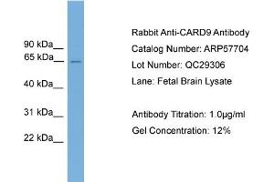 WB Suggested Anti-CARD9  Antibody Titration: 0. (CARD9 抗体  (Middle Region))