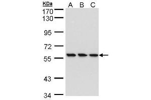WB Image Sample (30 ug of whole cell lysate) A: HeLa B: Hep G2 , C: MOLT4 , 7. (RNGTT 抗体)