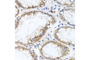 Immunohistochemistry of paraffin-embedded human stomach using GPM6A antibody (ABIN6134764, ABIN6141338, ABIN6141340 and ABIN6224880) at dilution of 1:100 (40x lens). (GPM6A 抗体  (AA 1-100))