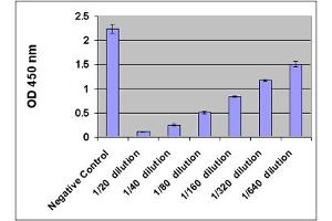8-OHdG Levels in Human Urine. (Oxidative DNA Damage ELISA 试剂盒)