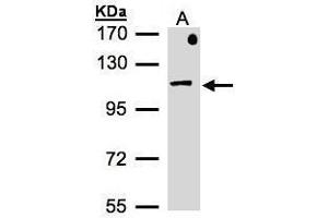 WB Image Sample(30 μg of whole cell lysate) A:MOLT4, 7. (AP2B1 抗体  (Internal Region))