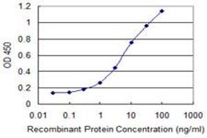 Detection limit for recombinant GST tagged PATZ1 is 0. (PATZ1 抗体  (AA 260-358))