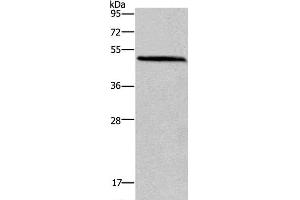 Western Blot analysis of Mouse brain tissue using HOMER1 Polyclonal Antibody at dilution of 1:400 (HOMER1 抗体)