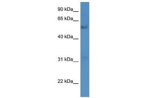 Western Blot showing FAM126A antibody used at a concentration of 1-2 ug/ml to detect its target protein.