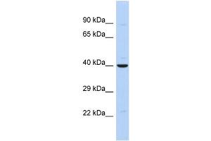 Host: Rabbit Target Name: ZNF551 Sample Type: MCF7 Whole cell lysates Antibody Dilution: 1. (ZNF551 抗体  (N-Term))