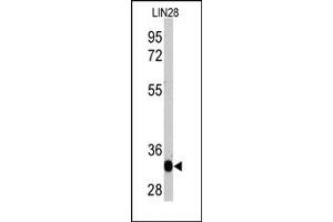 Western Blotting (WB) image for anti-Lin-28 Homolog A (C. Elegans) (LIN28A) antibody (ABIN356385) (LIN28A 抗体)