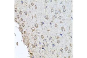 Immunohistochemistry of paraffin-embedded mouse brain using HBA2 antibody.