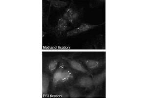 Immunofluorescence (IF) image for anti-Sequestosome 1 (SQSTM1) (AA 317-346) antibody (ABIN3031543)