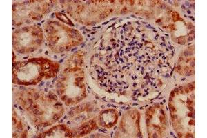 Immunohistochemistry of paraffin-embedded human kidney tissue using ABIN7142951 at dilution of 1:100 (SLC33A1 抗体  (AA 1-74))