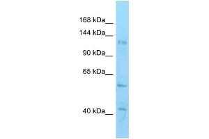 WB Suggested Anti-Hdac6 Antibody   Titration: 1. (HDAC6 抗体  (C-Term))