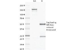SDS-PAGE Analysis Purified CD79b Mouse Monoclonal Antibody (IGB/1843). (CD79b 抗体  (AA 29-159))