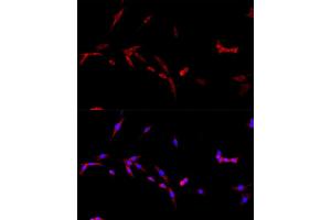 Immunofluorescence analysis of PC-12 cells using CD40L antibody (ABIN6133614, ABIN6138190, ABIN6138191 and ABIN6216826) at dilution of 1:100.