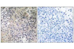 Immunohistochemistry analysis of paraffin-embedded human lung tissue using SHC3 antibody. (SHC3 抗体  (Internal Region))